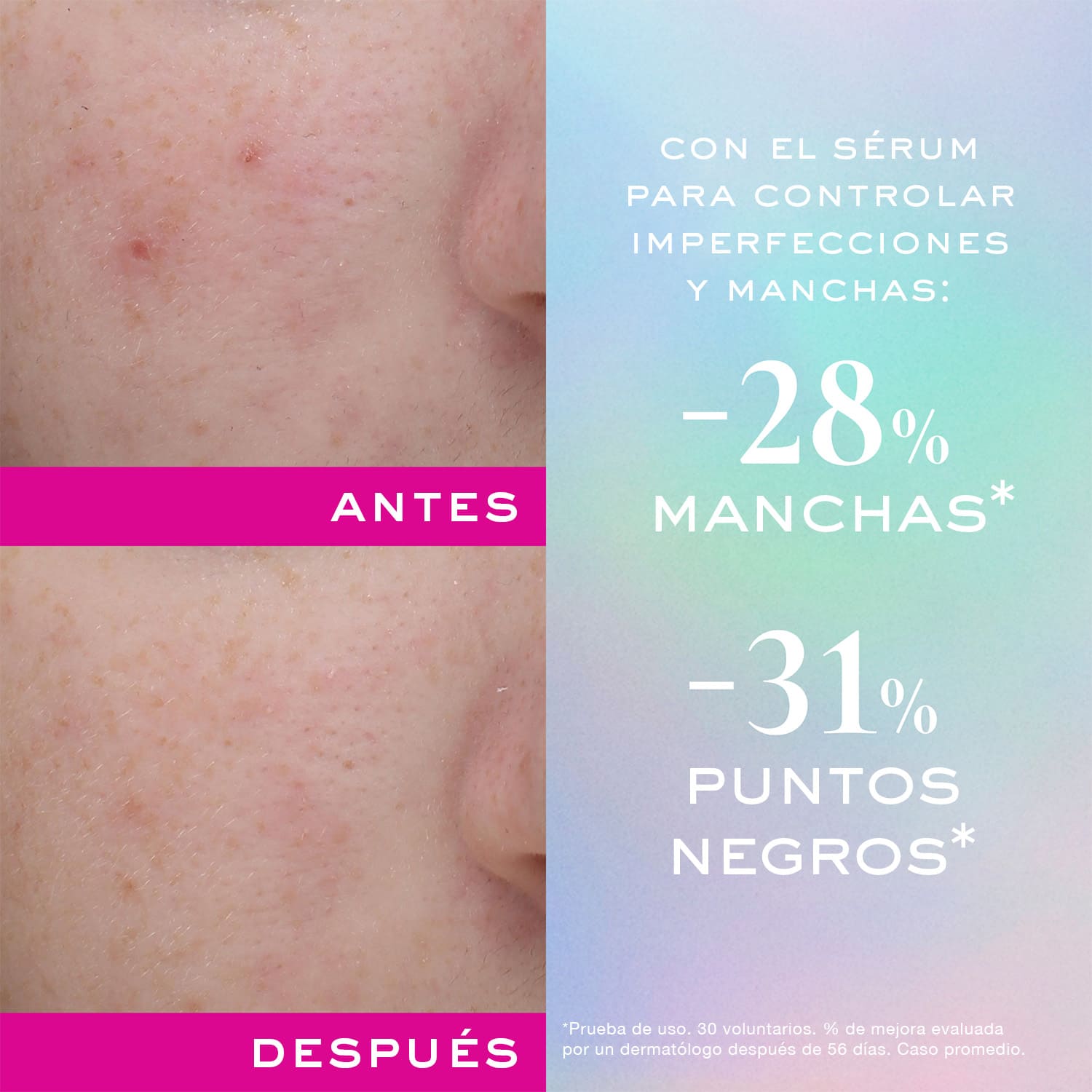 ZINC POWER- SERUM (SUERO CONTROL DE IMPERFECCIONES Y BROTES)